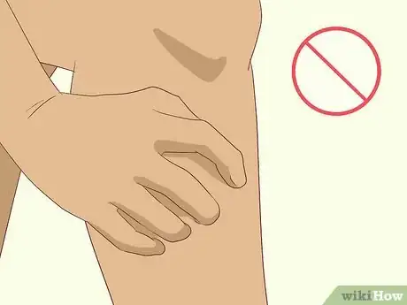 Image titled Soothe Itchy Legs Step 3