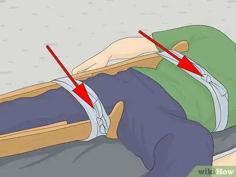 Image titled Make a Traction Splint for a Fractured Femur Step 6