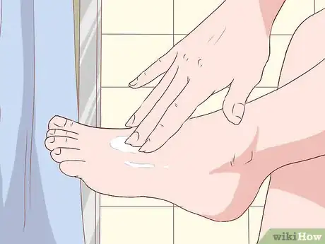 Image titled Prevent Skin Infections Step 7