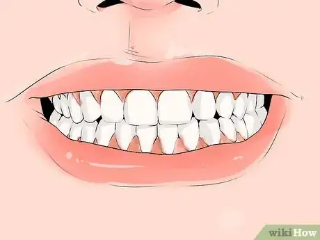 Image titled Identify if You Have Sensitive Teeth Step 5