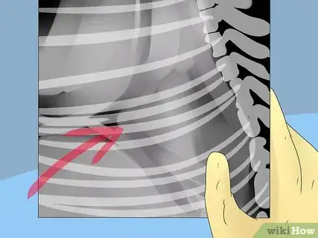 Image titled Diagnose a Cat Cough Step 12