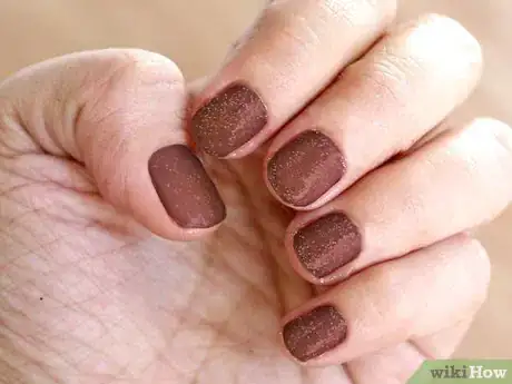 Image titled 2996350 16