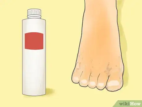 Image titled Use Foot Baths for Athlete’s Foot Step 1