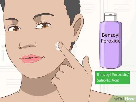 Image titled Remove an Ingrown Hair Step 2