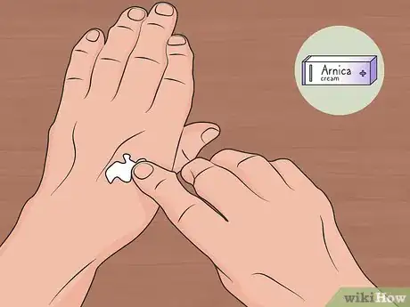 Image titled Use Arnica for Natural Remedies Step 01