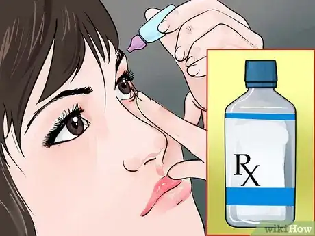 Image titled Help Prevent Eye Infections for Contact Lens Users Step 9