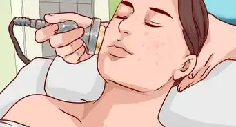 Get Rid of a Hard Pimple