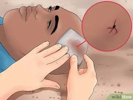 Image titled Evaluate for Head Injuries During First Aid Step 13