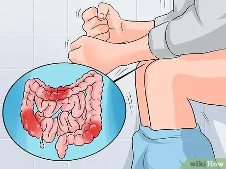 Image titled Differentiate Chronic Pancreatitis from Similar Conditions Step 2
