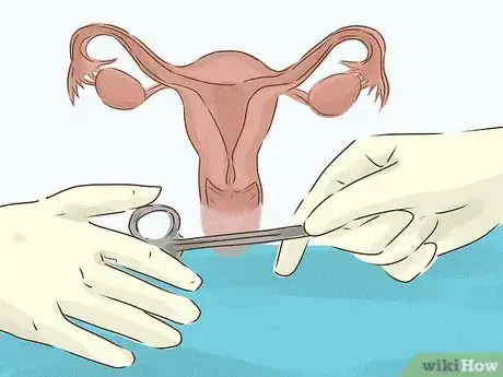 Image titled Treat Infertility Step 9