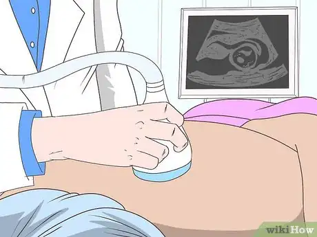 Image titled Recognize Preeclampsia Step 18