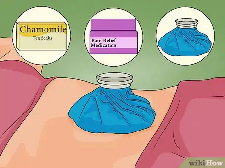 Image titled Care for a New Navel Piercing Step 16