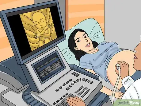 Image titled Deal with Amniotic Band Syndrome Step 2