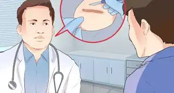 Prevent Keloid and Hypertrophic Scars