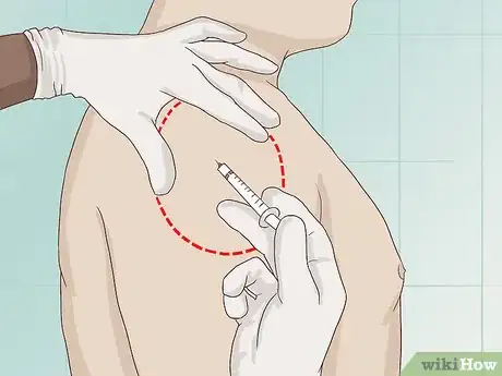 Image titled Deal with Spasticity Step 4