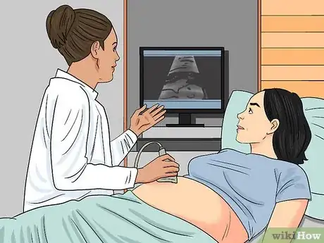 Image titled Deal with Amniotic Band Syndrome Step 1
