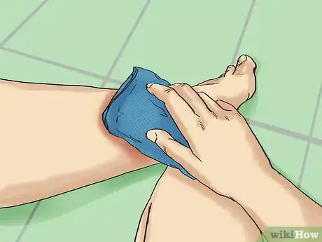 Image titled Care for a Tattoo During Removal Step 2