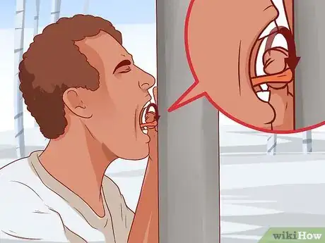 Image titled Remove a Tongue Stuck on Frozen Metal Step 5