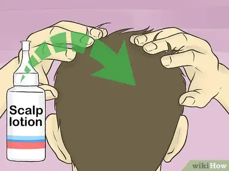 Image titled Prevent Dry Scalp Step 7