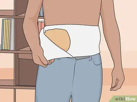 Image titled Get Used to an Ostomy Step 6