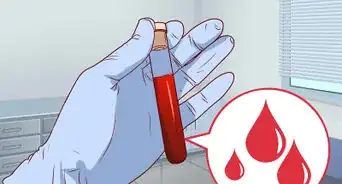 Get Immunized Against Chicken Pox