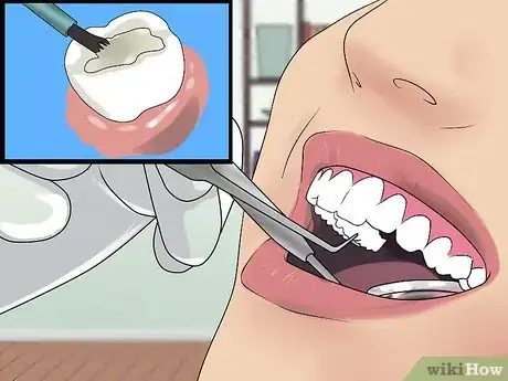 Image titled Prevent Fuzzy Teeth Step 5