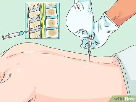 Image titled Diagnose Meningitis Step 7