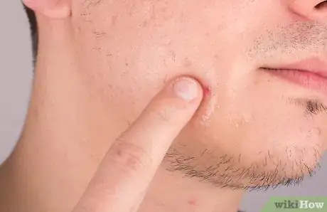 Image titled Use Lavender for Skin Care Step 6