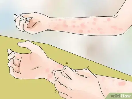 Image titled Avoid Skin Problems at Work Step 1