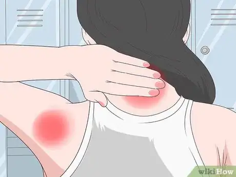 Image titled Treat Liver Disease Step 6