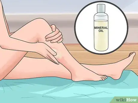 Image titled Soothe Psoriasis Flares Step 7