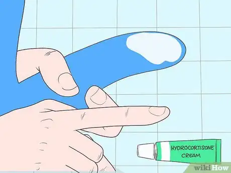 Image titled Cure Balanitis Step 3
