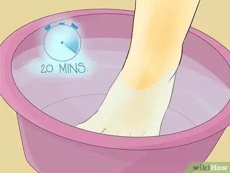 Image titled Use Foot Baths for Athlete’s Foot Step 7