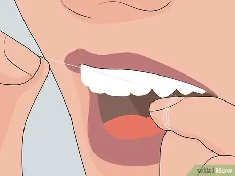 Image titled Home Treat a Toothache or Any Minor Mouth Infection Step 18