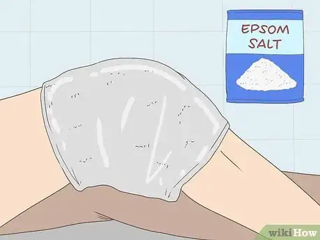 Image titled Manage Osteoarthritis Pain Step 4