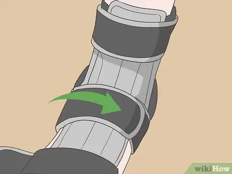 Image titled Wear a Dorsal Night Splint Step 5
