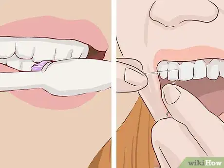 Image titled Treat Weak Tooth Enamel Step 11