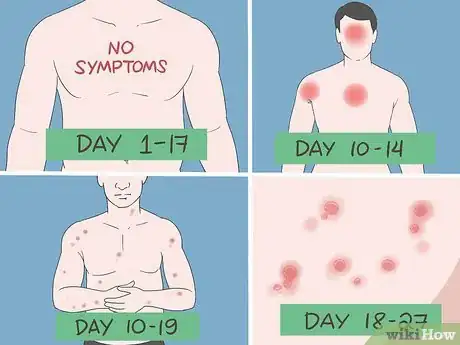 Image titled Prevent Smallpox Step 6