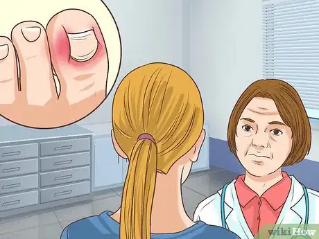 Image titled Treat a Torn Toenail Step 12