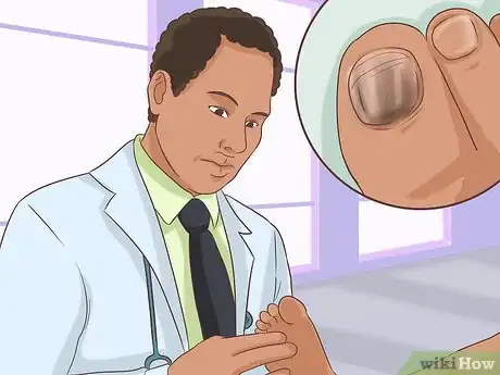 Image titled Treat a Torn Toenail Step 13