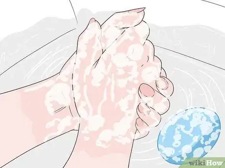 Image titled Treat Adenovirus Step 9