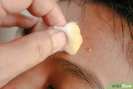 Image titled Make a Honey Face Mask Step 5