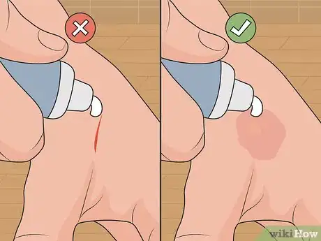 Image titled Use Arnica for Natural Remedies Step 06