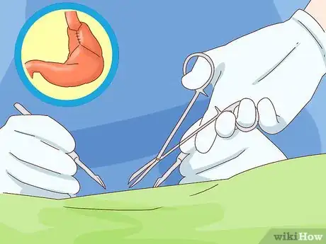 Image titled Help a Baby with Reflux Step 18