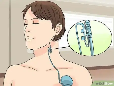 Image titled Prevent Epilepsy Step 12