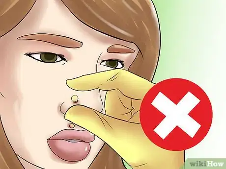 Image titled Take Out a Monroe Piercing Step 10