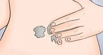 Prepare Your Body for Pregnancy