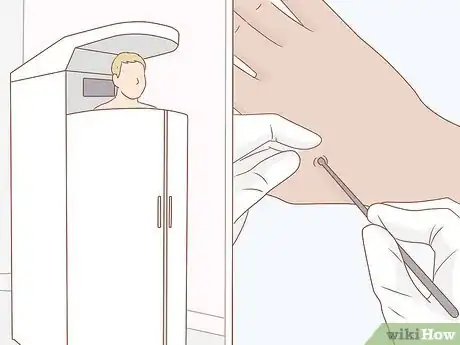 Image titled Prevent Molluscum (Molluscum Contagiosum) Step 10