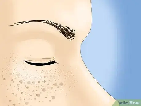 Image titled Prevent Hyperpigmentation of the Skin Step 3