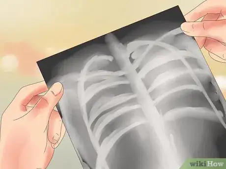 Image titled Diagnose Lung Hyperinflation Step 11